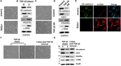 Wnt2 Contributes to the Development of Atherosclerosis